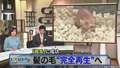 「発毛」に成功 髪の毛“完全再生”へ