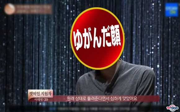 「ゆがんだ顔で人生までもゆがんだ」男性がアイドルのようなイケメンに奇跡の大変身！？