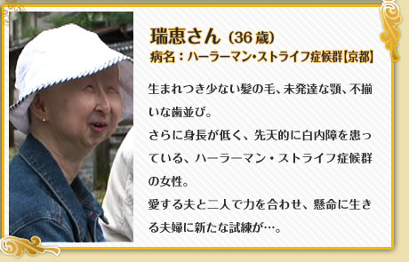 瑞恵さん （36歳）病名：ハーラーマン・ストライフ症候群【京都】生まれつき少ない髪の毛、未発達な顎、不揃いな歯並び。さらに身長が低く、先天的に白内障を患っている、ハーラーマン・ストライフ症候群の女性。愛する夫と二人で力を合わせ、懸命に生きる夫婦に新たな試練が…。