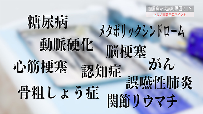 朝すぐ・昼さっと・夜しっかり　歯周病を防ぐ歯磨き術