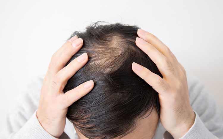 薄毛 抜け毛の悩みを解消 成功率95 のプロが教える髪が増えるケア テレ東プラス