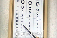 視力検査