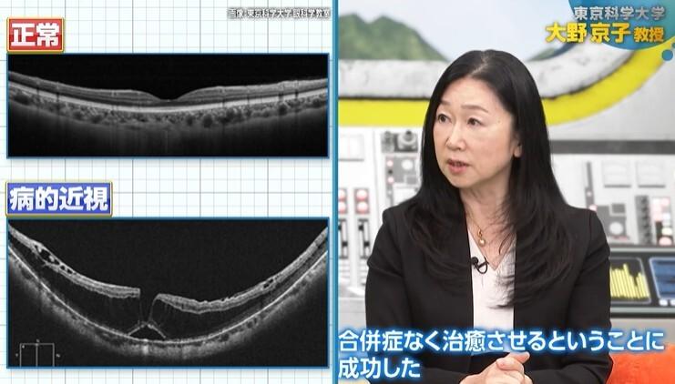 記事画像