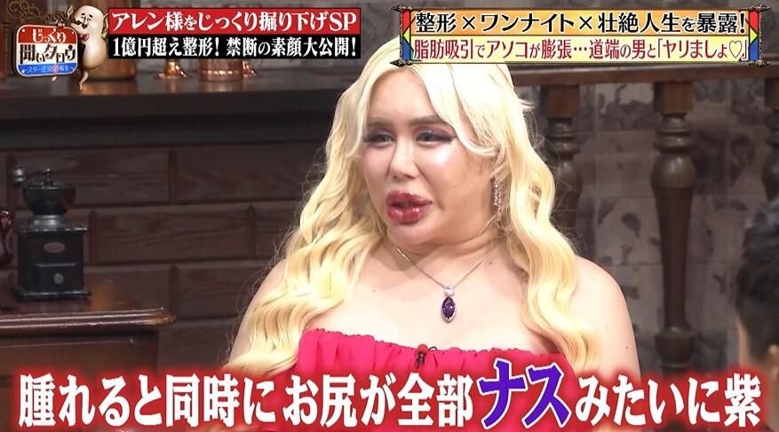 記事画像