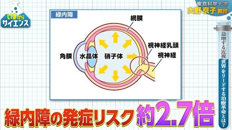 記事画像