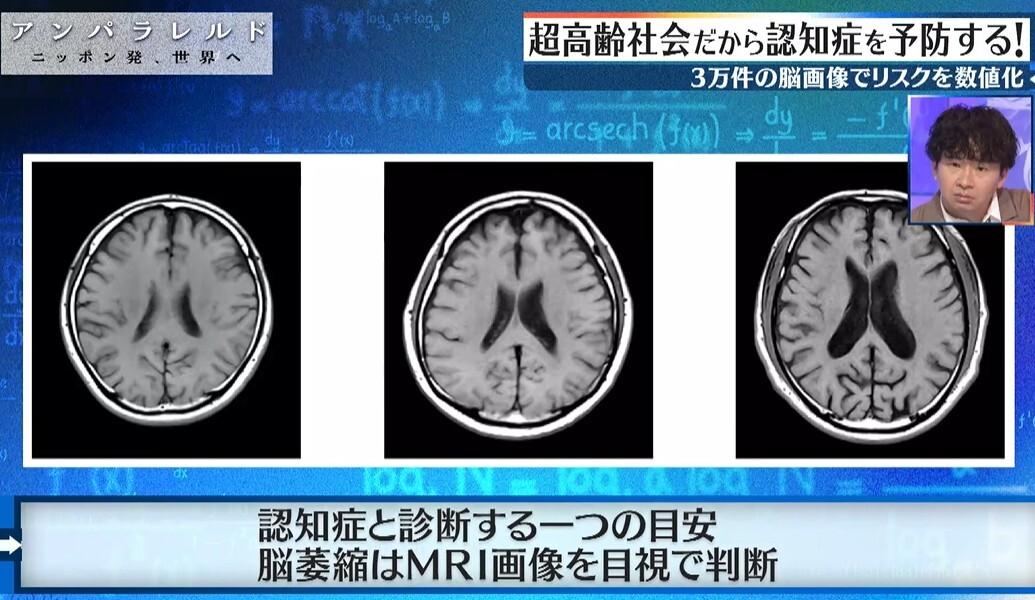 記事画像