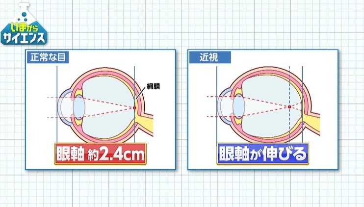 記事画像