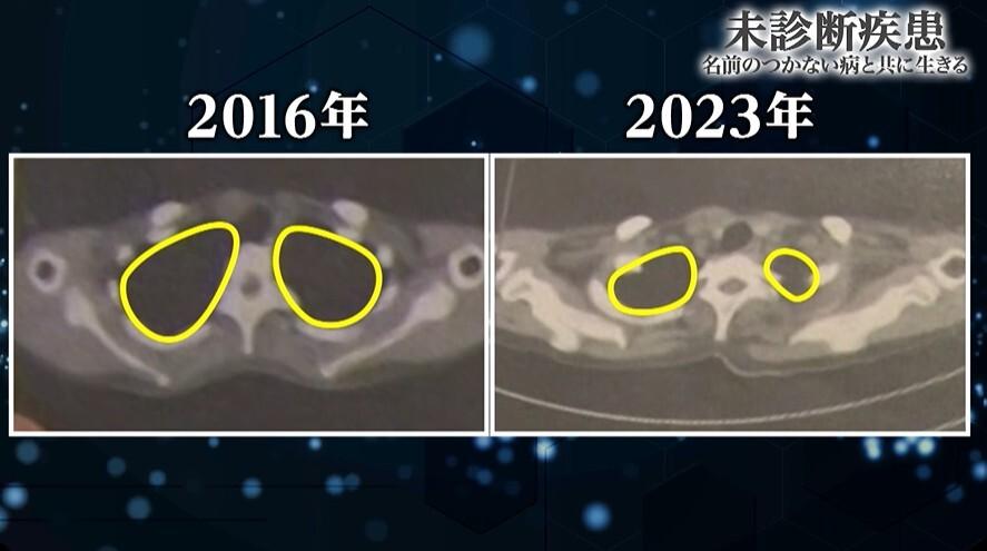 【未診断疾患】約3300人に1人…患者たちが直面する過酷な現実[11]
