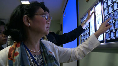 加藤医師が動脈瘤のレントゲンを見ている所